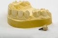 Dental Impression, Crown Implant Royalty Free Stock Photo